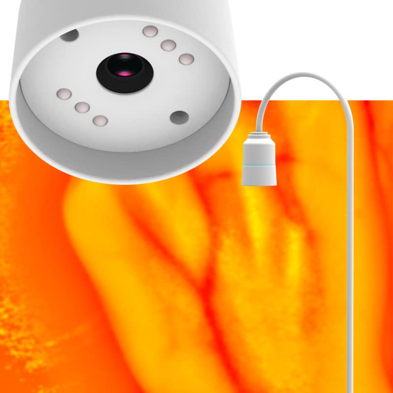 [AUSTRALIA] - HURRISE Vein Finder Illuminates Imaging Vein Finder Transilluminator Permanent Vein Finder Display Machine Transilluminator Vein Finder for Hospital 