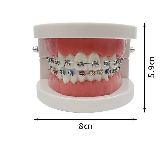 Tooth Demonstration Model, Teeth Dental Demonstration Model, Dental Typodont Teeth Model with Orthodontic Metal Clamp for Dentist Teaching Research Dental