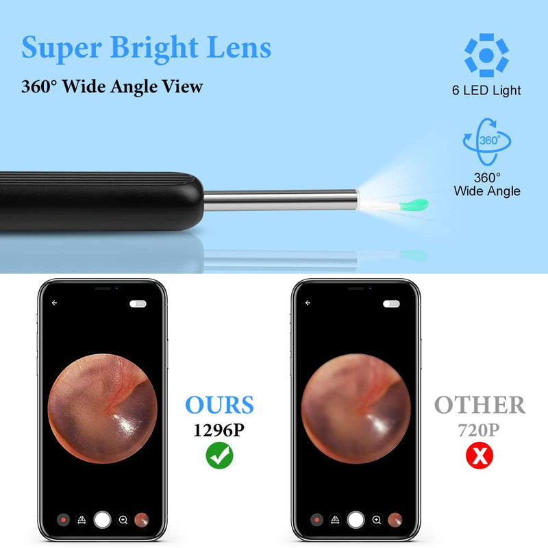 ACWOO Ear Wax Remover Otoscope, Ear Cleaner Camera Ultra Thin, IP67 Waterproof Ear Endoscope Ear Cleaner for Adults, Wireless HD Otoscope for Adults, Children and Pets, Black