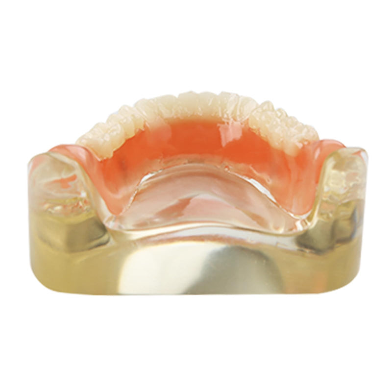 Dental Model Upper Jaw Deck Prosthesis with 2 Implants for Training and Study (Upper Jaw)