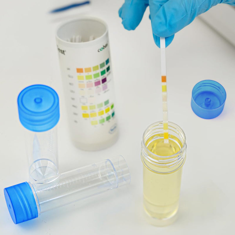 FERCAISH Pack of 10 Sample Tubes with Blue Screw Lid, 30 ml Sample Tube, Disposable Urine Tubes, Plastic Marker, Test Tubes, for Laboratory and Hospital