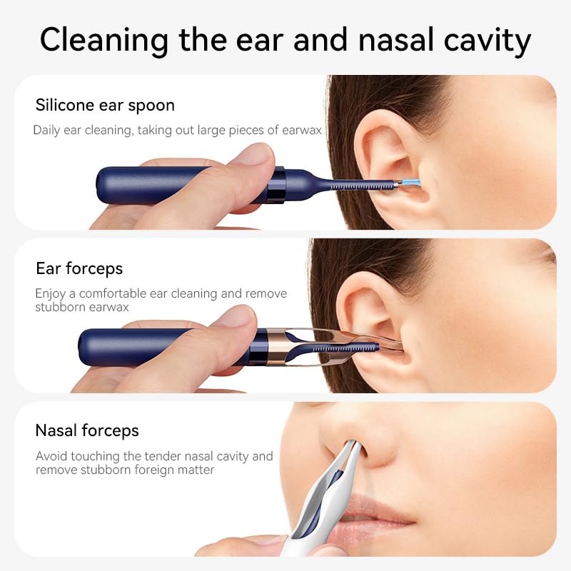 Ear Wax Remover Otoscope, Ear Wax Removal Camera Light Tool Set, 1080P HD WiFi Ear Cleaner with 4 LEDs, IP67 Waterproof & 360° Wide Angle Otoscope Camera, for iPhone, Android, iPad