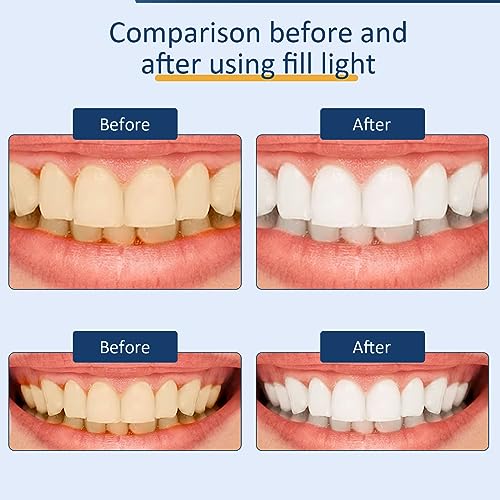 Dental Photography Aid Dental Fill Light Oral Cell Phone Camera Supplementary Light Camera Photo Light for Cosmetology Macro Photography Product Photography