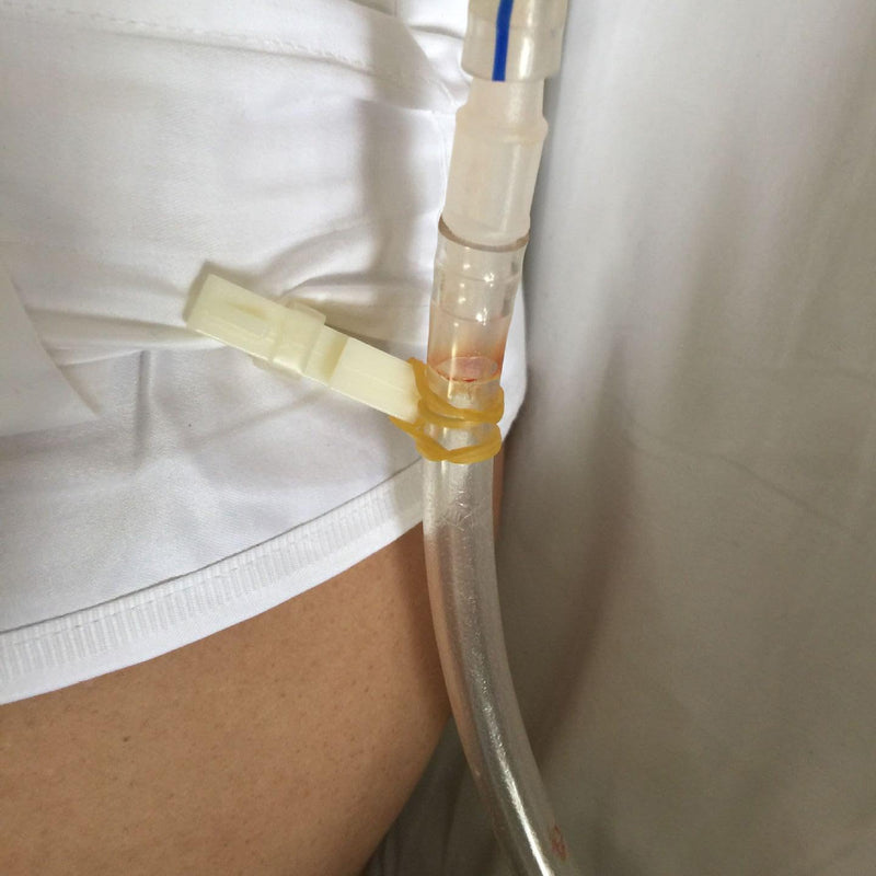 [AUSTRALIA] - Catheter Stabilising Device Cloth Pegs Clamp Catheter Fixing Holder Clamps Tube Mounting Clips Laundry Pen Hose Attachment Accessories Accessories 5 Pieces 