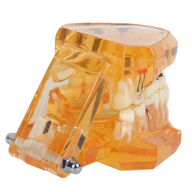 Dental Model for Teaching, Dental Degeneration Model Demonstration Study Orange Model Dentures