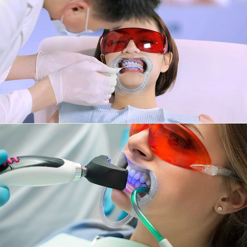 Vicloon Cheek Holder Mouth Angle Holder for Mouth Opener Challenge, 10 Pieces Dental C-Shape Mouth Opener for Teeth Whitening (Transparent) Transparent