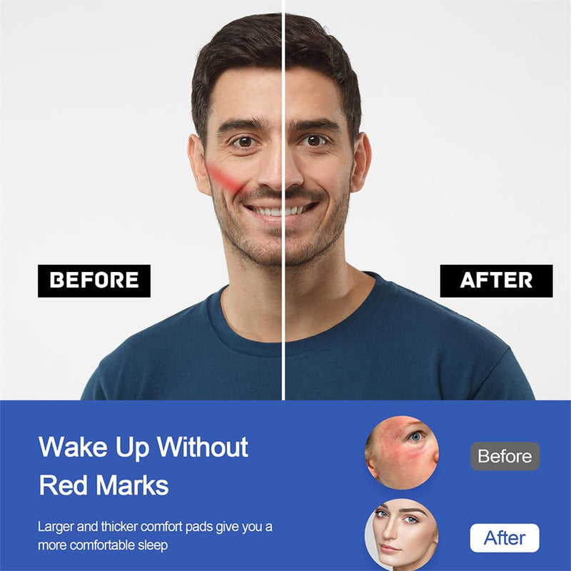 CPAP Strap Covers, Pack of 6, CPAP Face Pads, CPAP Face Pads, CPAP Strap, Comfort Pads, CPAP Facial Pad, CPAP Accessories for Reducing Cheek, Red Spots and Indentations