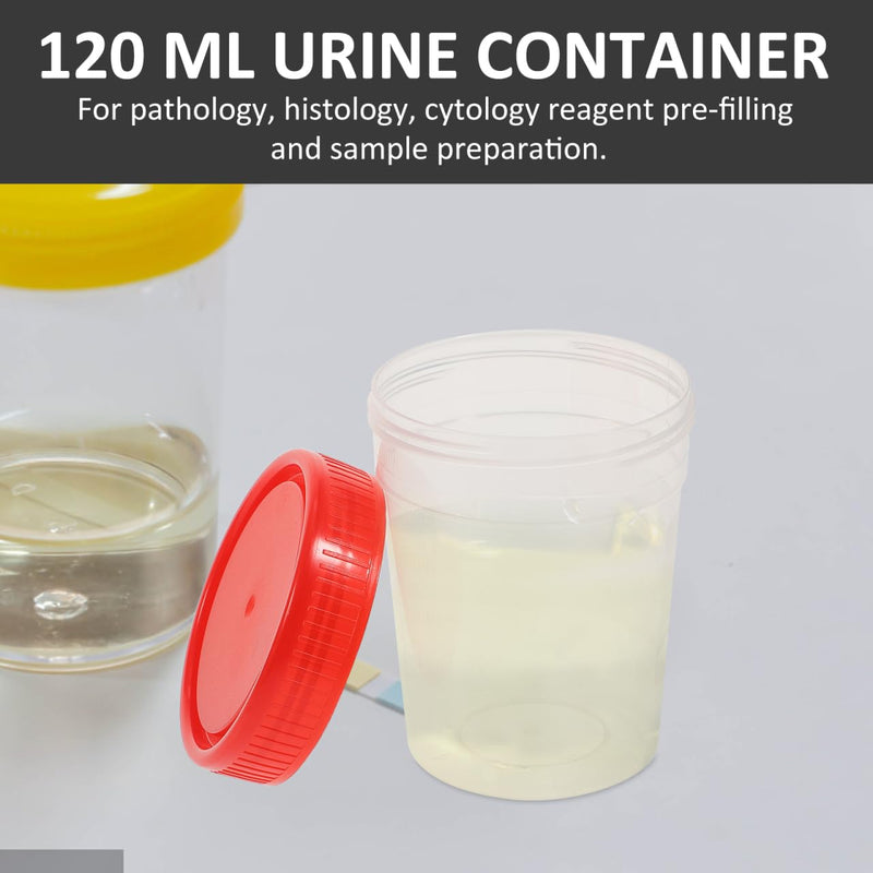iplusmile 10 Pieces Urine Cups - 120 ml Sample Cup with Screw Lid Urine Sample Cup Urine Sample Cups Bottle with Graduated for Home Laboratory (Random Colour)