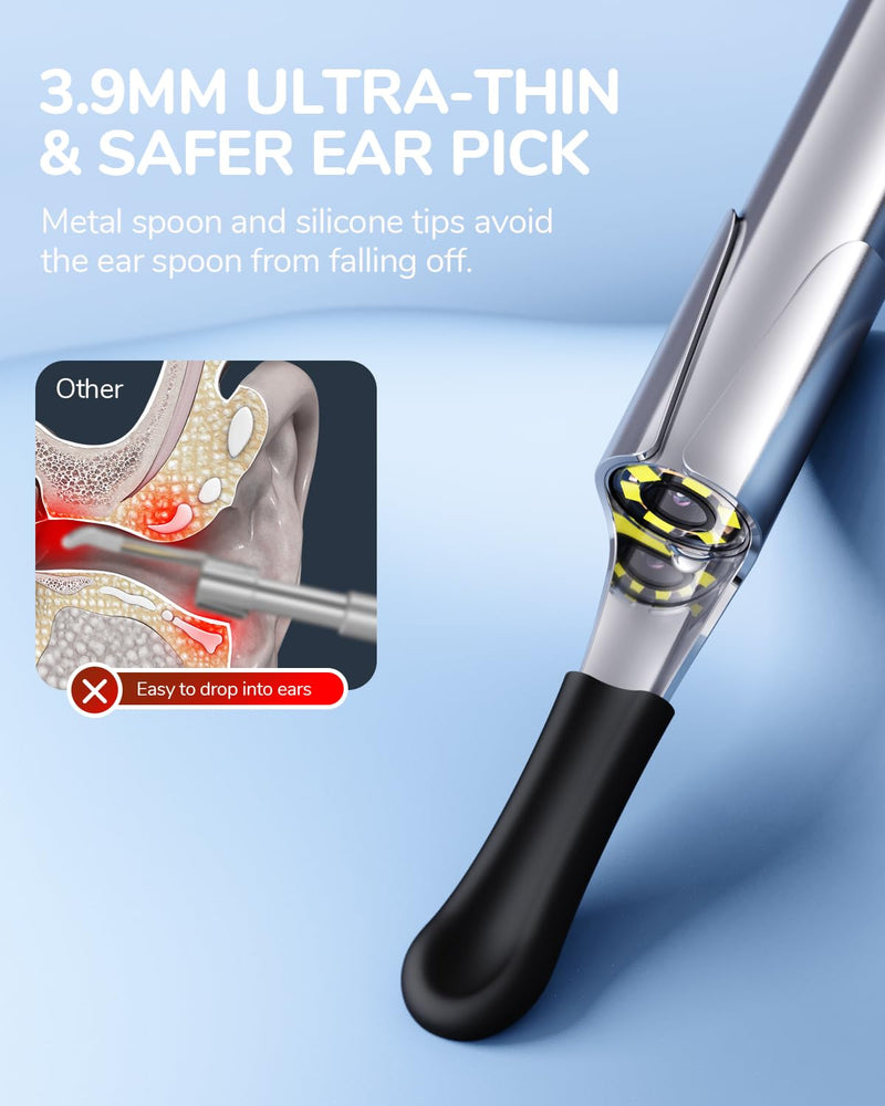 [AUSTRALIA] - ScopeAround Otoscope with Light, 1080P FHD Ear Scope, 3.9mm Digital Otoscope Camera with 6 LED Lights Ear Wax Removal Tool Camera, Ear Scope with Light, Compatible with USB-C 