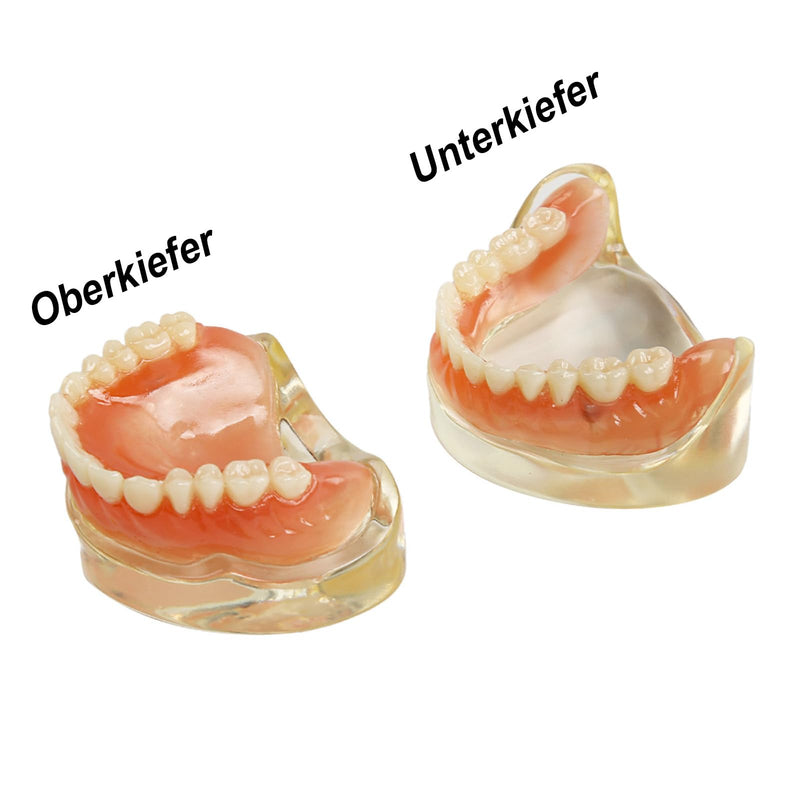 Dental Model Upper Jaw Deck Prosthesis with 2 Implants for Training and Study (Upper Jaw)