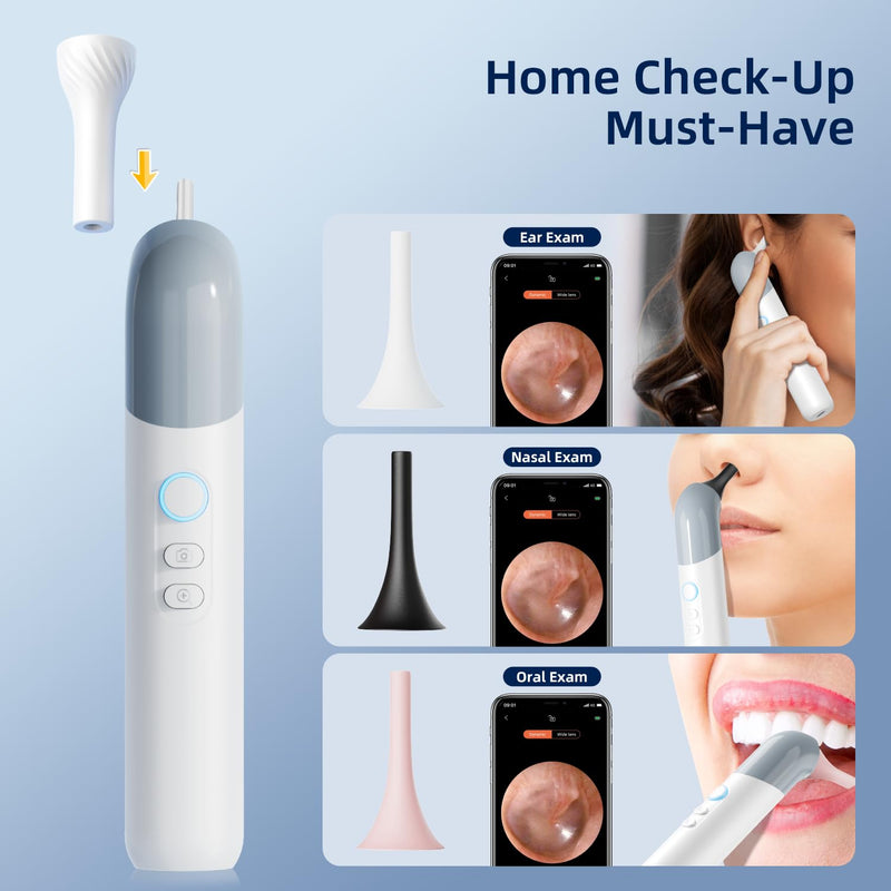 Qimic Wireless Otoscope Ear Camera - 1080P WiFi Otoscope with 6 LED Lights, Ear Scope Camera with 10 Colorful Accessories for Kids,Pets &Adults,Support Photo and Video, Compatible with Android Q09