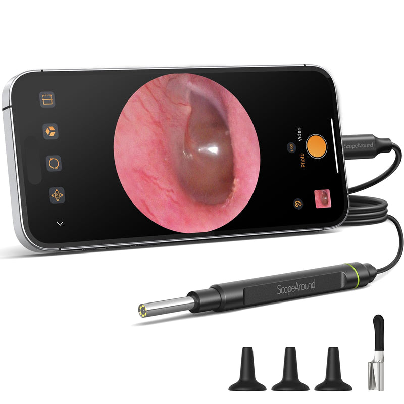 [AUSTRALIA] - ScopeAround Otoscope with Light, 1080P FHD Ear Scope, 3.9mm Digital Otoscope Camera with 6 LED Lights Ear Wax Removal Tool Camera, Ear Scope with Light, Compatible with USB-C 