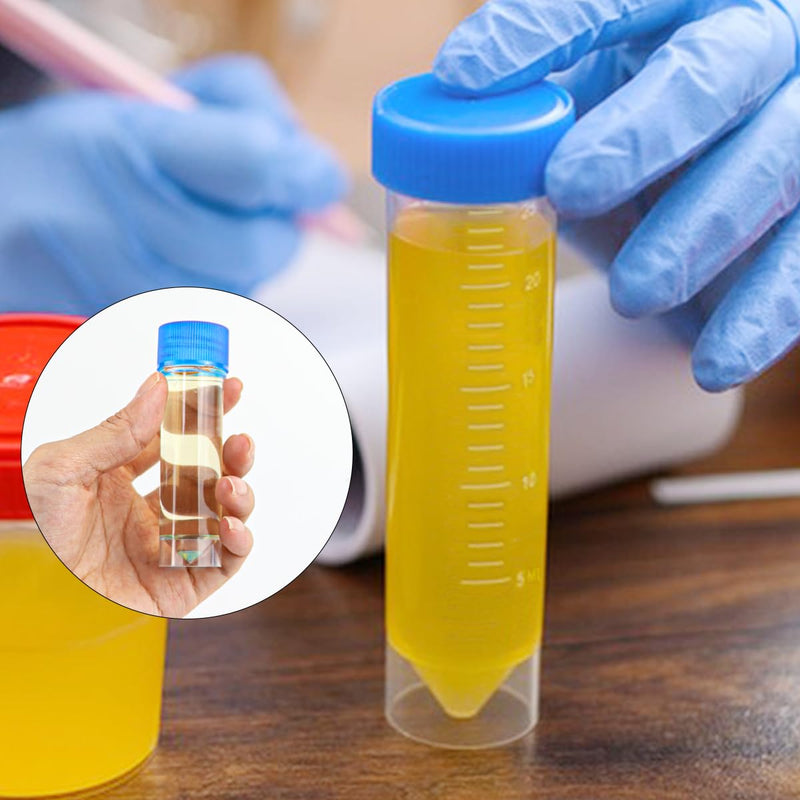 FERCAISH Pack of 10 Sample Tubes with Blue Screw Lid, 30 ml Sample Tube, Disposable Urine Tubes, Plastic Marker, Test Tubes, for Laboratory and Hospital