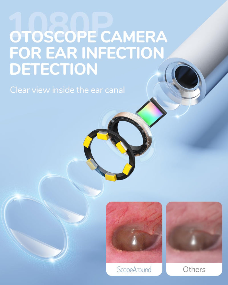 [AUSTRALIA] - ScopeAround Otoscope with Light, 1080P FHD Ear Scope, 3.9mm Digital Otoscope Camera with 6 LED Lights Ear Wax Removal Tool Camera, Ear Scope with Light, Compatible with USB-C 