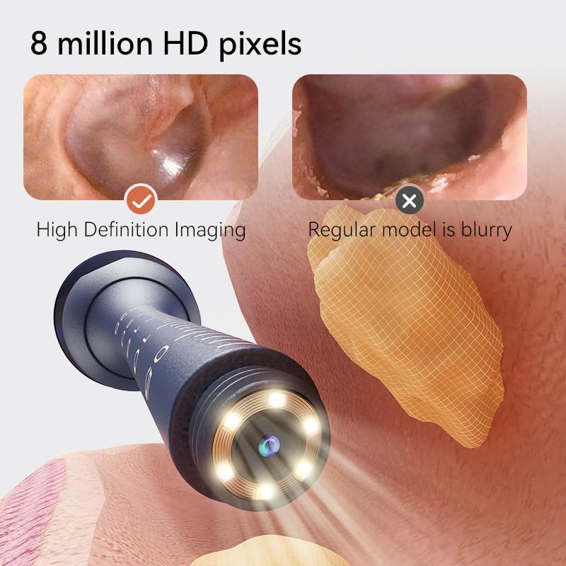 Ear Wax Remover Otoscope, Ear Wax Removal Camera Light Tool Set, 1080P HD WiFi Ear Cleaner with 4 LEDs, IP67 Waterproof & 360° Wide Angle Otoscope Camera, for iPhone, Android, iPad