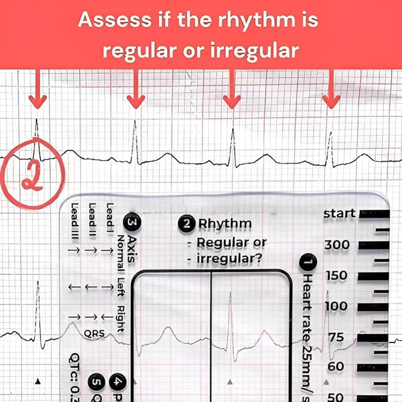ECG 7 Step Ruler, ECG 7 Step Ruler for ECG/EKG Interpretation, ECG Ruler Plastic Ruler Measuring Tool, ECG Ruler Transparent, ECG Ruler Pocket etcard, Easy-to-Carry ECG Ruler (2 Pieces (with box))