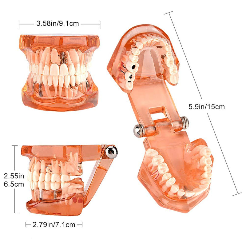 Dental Model for Teaching, Dental Degeneration Model Demonstration Study Orange Model Dentures