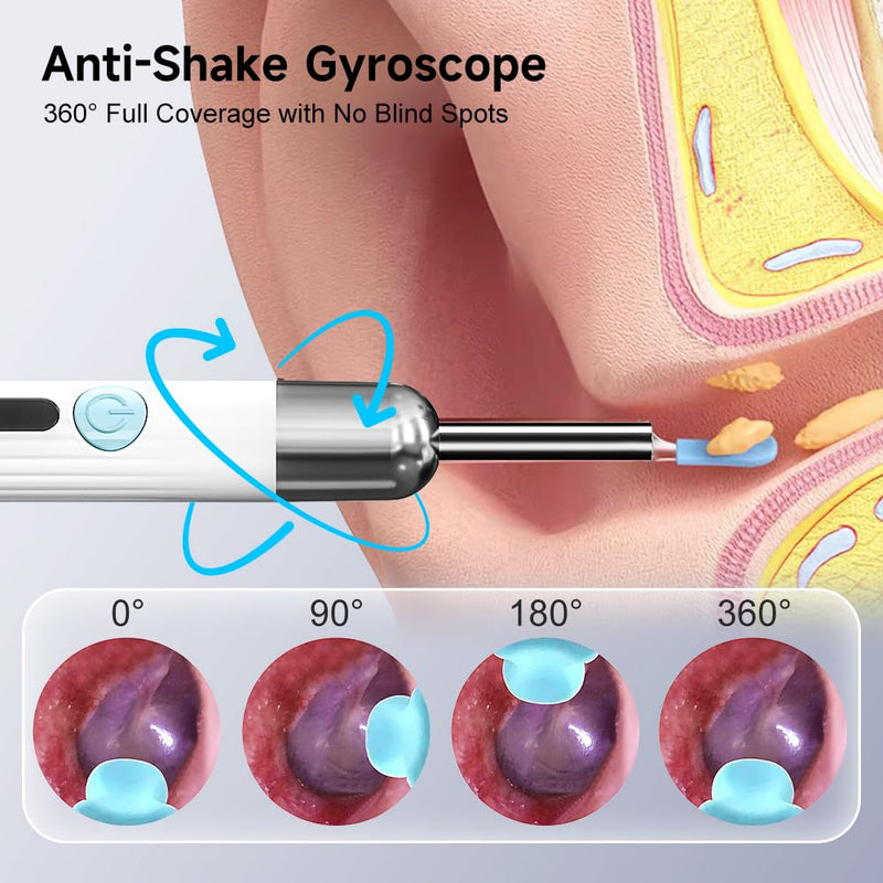 Ear Wax Remover Otoscope, 1080P WiFi Ear Cleaner with UV-C Charging Station, IP67 Waterproof Otoscope Ear with 6 LEDs for iOS and Android Smartphones Digital Ear Scoop with Camera
