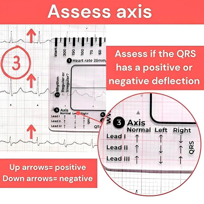 ECG 7 Step Ruler, ECG 7 Step Ruler for ECG/EKG Interpretation, ECG Ruler Plastic Ruler Measuring Tool, ECG Ruler Transparent, ECG Ruler Pocket etcard, Easy-to-Carry ECG Ruler (2 Pieces (with box))