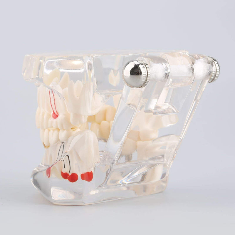 Model of Dentist Training, Dental Implant Disease Teaching Study Analysis Adult Typodont Demonstration Teeth Model New