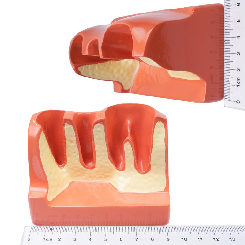 [AUSTRALIA] - Sarini Oral Dental Model, Dental Implant Model with Removable Crown and Bridge, Suitable for Classroom Demonstrations and Dental Student Training 