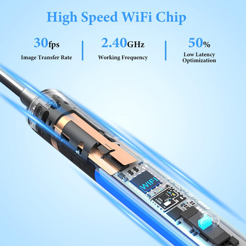 ACWOO Ear Wax Remover Otoscope, Ear Cleaner Camera Ultra Thin, IP67 Waterproof Ear Endoscope Ear Cleaner for Adults, Wireless HD Otoscope for Adults, Children and Pets, Black