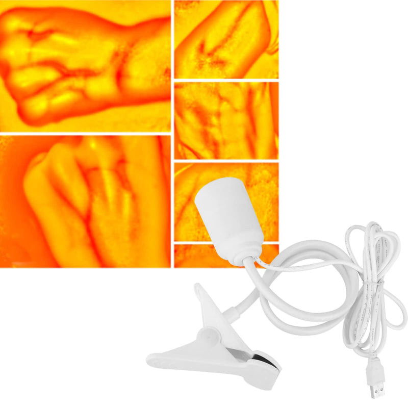 [AUSTRALIA] - HURRISE Vein Finder Illuminates Imaging Vein Finder Transilluminator Permanent Vein Finder Display Machine Transilluminator Vein Finder for Hospital 
