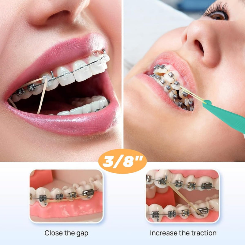 Pack of 500 Braces Rubber, Orthodontic Rubber Bands, Orthodontic Elastic with 10 Pieces Placer Braces Can Be Used for Orthodontics