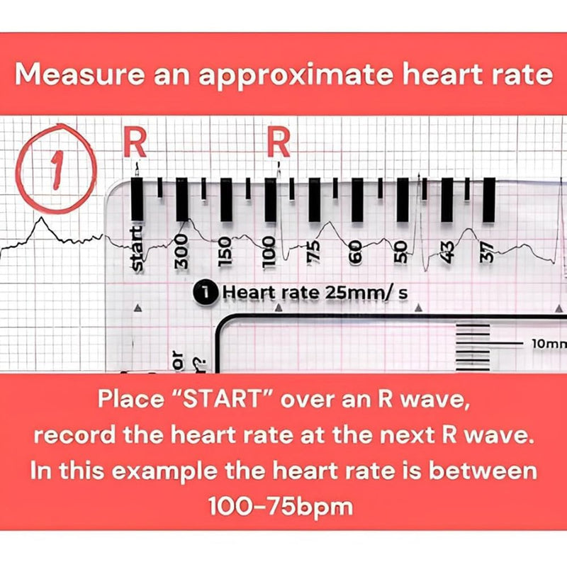 ECG 7 Step Ruler, ECG 7 Step Ruler for ECG/EKG Interpretation, ECG Ruler Plastic Ruler Measuring Tool, ECG Ruler Transparent, ECG Ruler Pocket etcard, Easy-to-Carry ECG Ruler (2 Pieces (with box))