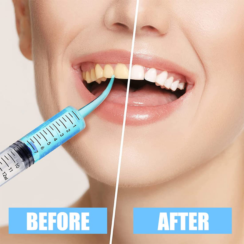 Syringe 12 ml Plastic Curved Syringe Mouth Syringe Dental Irrigation Syringe Wisdom Teeth Syringe for Oral Dental Care Cleaning