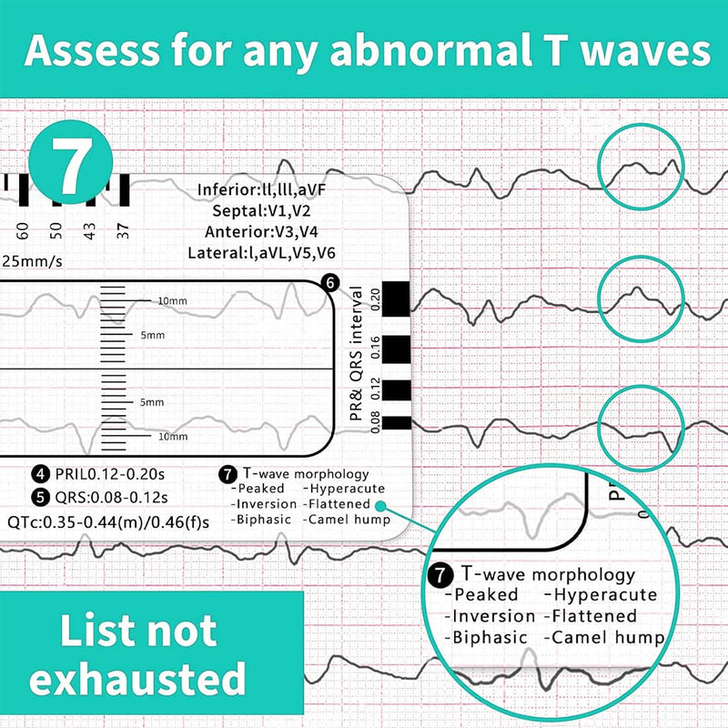 [AUSTRALIA] - HQRKOTM ECG 7 Level Ruler Card for ECG/ECG Interpretation, Portable Bag, Plastic, 85.6 mm x 53.98 mm, Medical Instrument, Simple Plastic Construction, ECG 7 Step Ruler, Pack of 2, a 