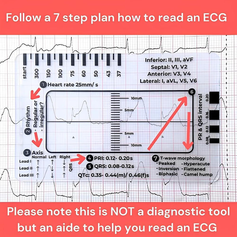 ECG 7 Step Ruler, ECG 7 Step Ruler for ECG/EKG Interpretation, ECG Ruler Plastic Ruler Measuring Tool, ECG Ruler Transparent, ECG Ruler Pocket etcard, Easy-to-Carry ECG Ruler (2 Pieces (with box))