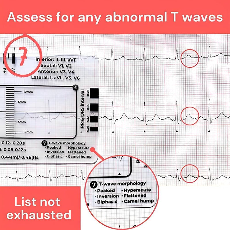 ECG 7 Step Ruler, ECG 7 Step Ruler for ECG/EKG Interpretation, ECG Ruler Plastic Ruler Measuring Tool, ECG Ruler Transparent, ECG Ruler Pocket etcard, Easy-to-Carry ECG Ruler (2 Pieces (with box))