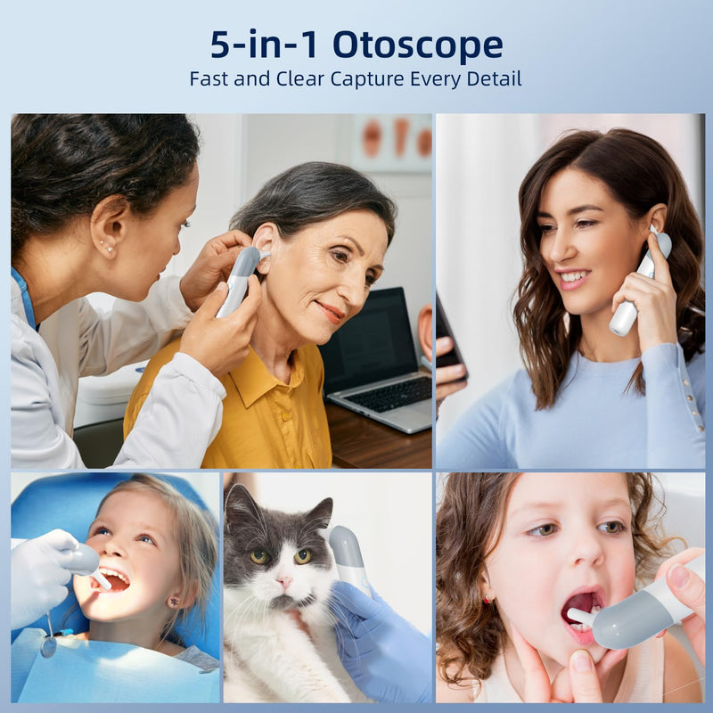 Qimic Wireless Otoscope Ear Camera - 1080P WiFi Otoscope with 6 LED Lights, Ear Scope Camera with 10 Colorful Accessories for Kids,Pets &Adults,Support Photo and Video, Compatible with Android Q09