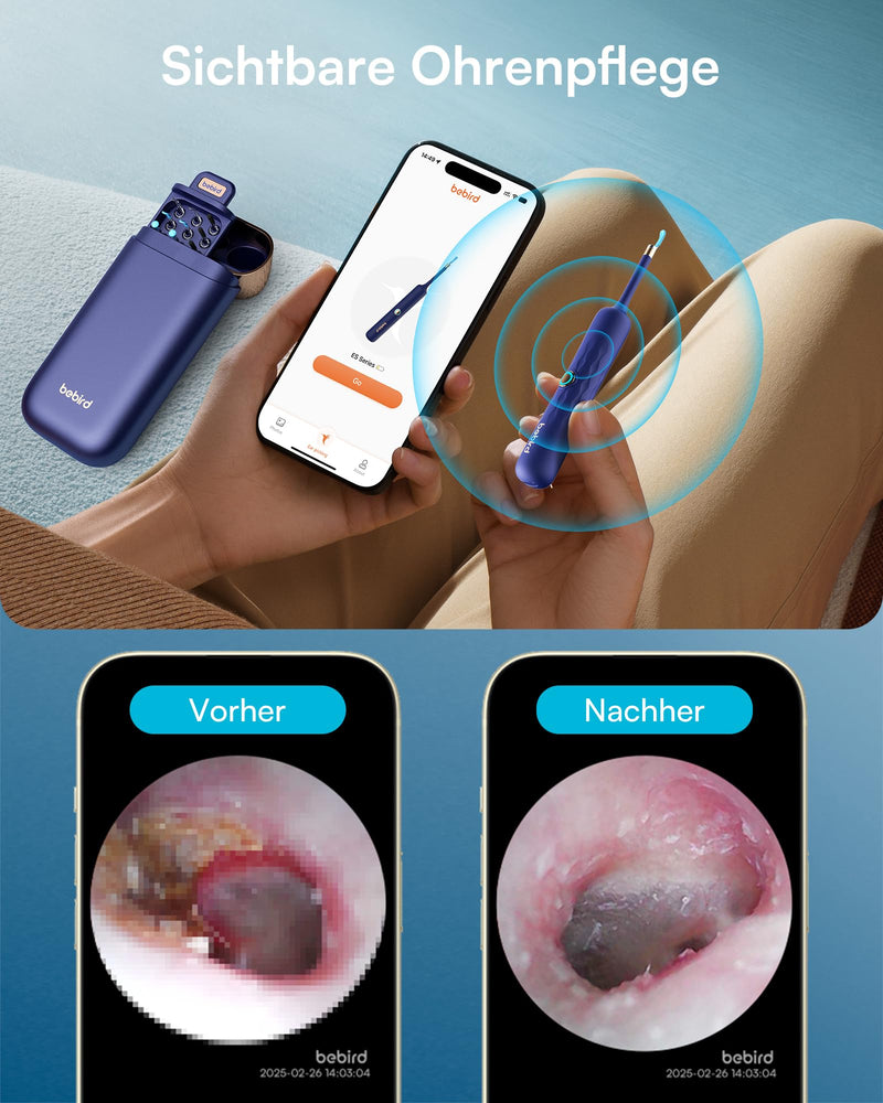 BEBIRD Earsight Plus D39R Ear Wax Remover Otoscope, 1920P HD Flexible Ear Cleaner Camera with Tweezers, Ear Cleaner Camera for Ear/Nose/Neck Examinations (Blue) Blue