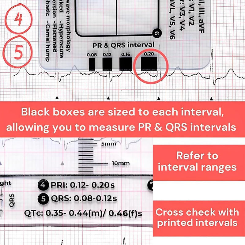 ECG 7 Step Ruler, ECG 7 Step Ruler for ECG/EKG Interpretation, ECG Ruler Plastic Ruler Measuring Tool, ECG Ruler Transparent, ECG Ruler Pocket etcard, Easy-to-Carry ECG Ruler (2 Pieces (with box))