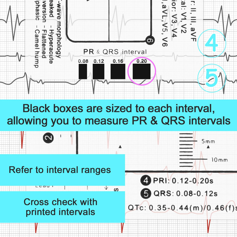 ECG 7 Step Ruler, Portable ECG Assessment Tool ECG/ECG 7 Step Ruler Card for ECG/ECG Interpretation ECG Ruler Plastic Ruler Measuring Tool ECG ECG Card Ruler ECG Reference Guide with Protect Sheath