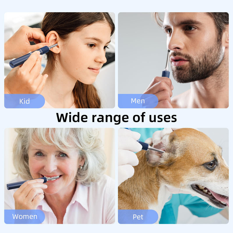 Qimic Ear Wax Remover Otoscope, 1080P HD WiFi Ear Cleaner, Ear Camera with Tweezers & 4 LEDs, Otoscope for iOS & Android, IP67 Waterproof Ear Cleaner for Adults, Children and Pets S8 blue