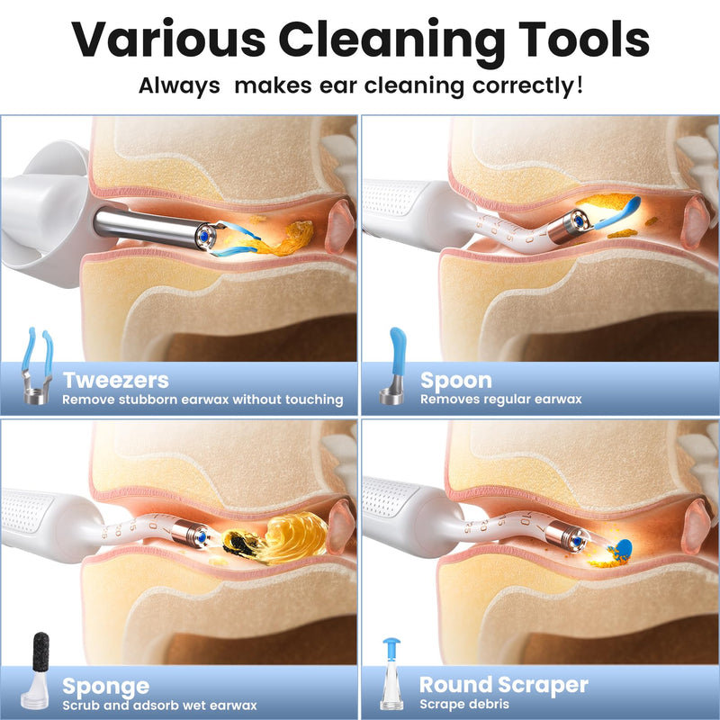 Flexible Ear Wax Removal Tool Camera, Wireless Smart Visual Ear Cleaner with 1080P HD Ear Scope with 12 Soft Tips, Painless Tweezers, 3 Inspection Heads, Portable Earwax Removal Kit for Adults & Kids