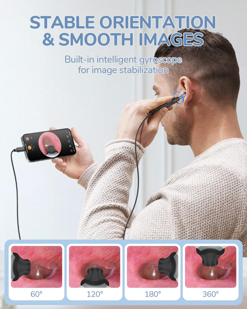 [AUSTRALIA] - ScopeAround Otoscope with Light, 1080P FHD Ear Scope, 3.9mm Digital Otoscope Camera with 6 LED Lights Ear Wax Removal Tool Camera, Ear Scope with Light, Compatible with USB-C 