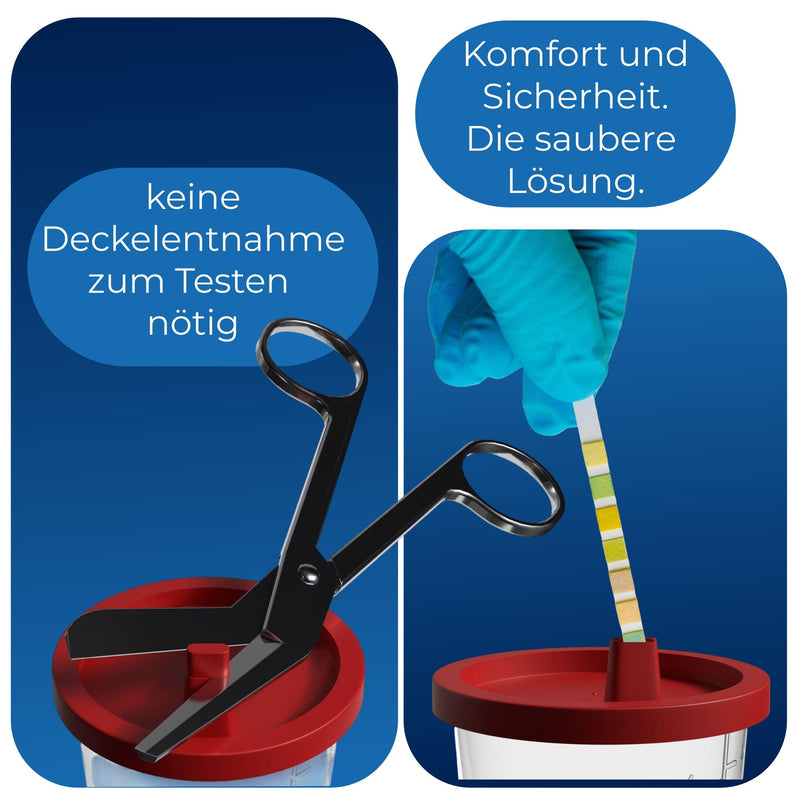 Horn Medical Urine Cup / Sample Cup with Snap Closure 150 ml Capacity, Size Chart up to 125 ml/4 oz, Can Be Written On (25) 25