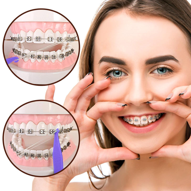 VEGCOO Pack of 600 Orthodontic Rubber Bands, 3/8 Inch, Braces Accessories with 6 Placers, Dental Orthodontic Rubber Bands for Dental Braids Braces Dental Gaps (Monkey) Monkey