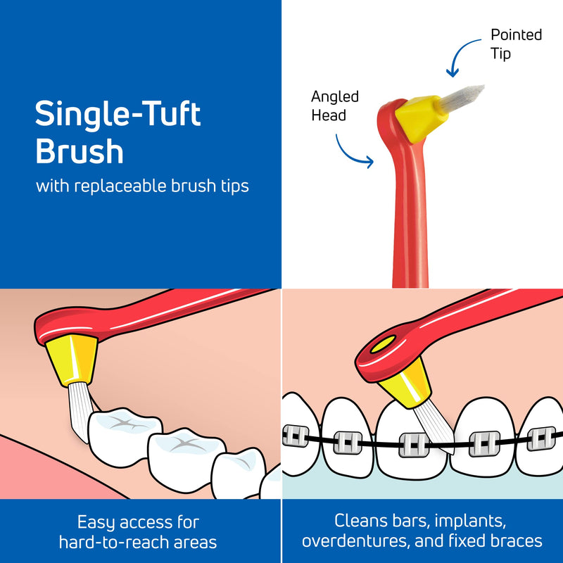 TePe Interspace Angled Soft Toothbrush for Braces with Single-End Tuft and Removable Head, 12 Pack