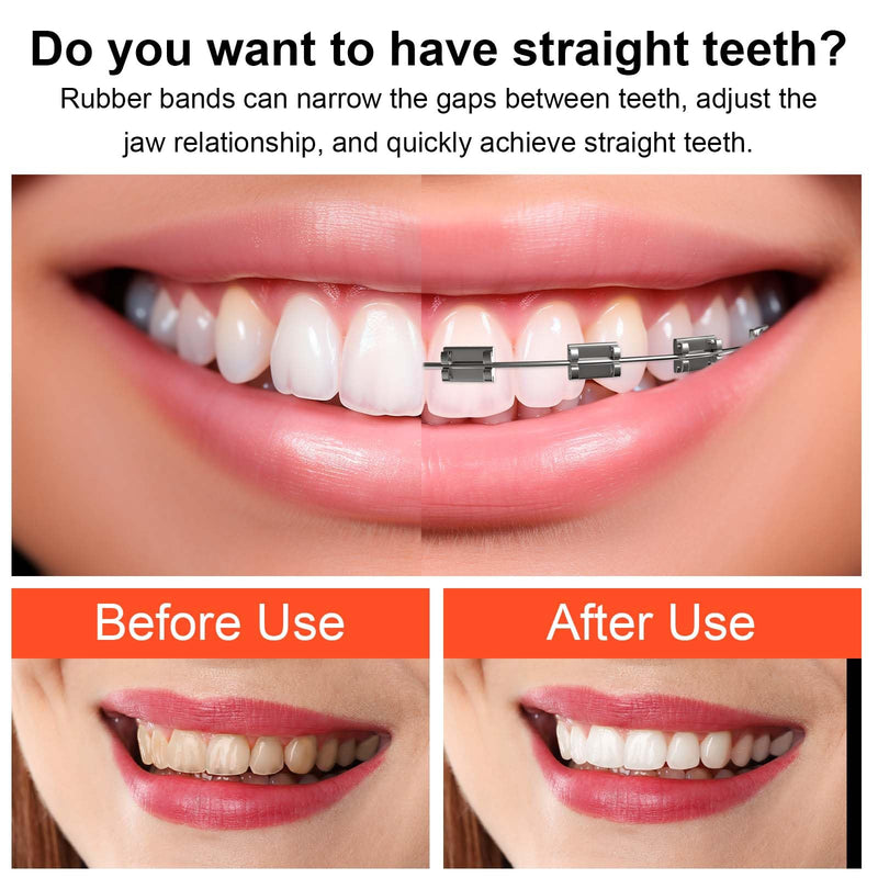 Orthodontic Rubber Bands 3/16