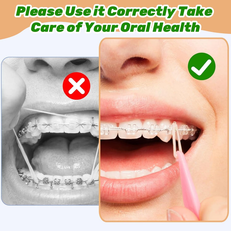 Pack of 500 Braces Rubber, Orthodontic Rubber Bands, Orthodontic Elastic with 10 Pieces Placer Braces Can Be Used for Orthodontics