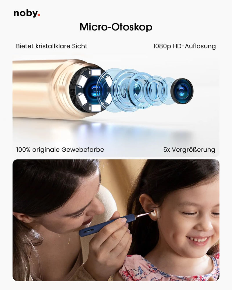 Noby 1920P HD otoscope: ear wax remover with camera for adults and children. Ear cleaner, human ear cleaner, ear cleaner with camera, ear cleaner for adults, otoscope