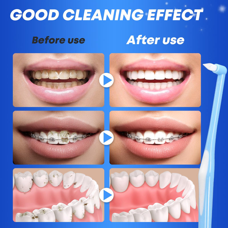 [AUSTRALIA] - Sularpek Pack of 4 Tuft Toothbrush, Tuft Brush with Independent Protective Caps, Soft Tufted Toothbrush, Interdental Brush for Orthodontic Braces and Bridges, Detail Cleaning Pack of 4 Tuft Toothbrushes 