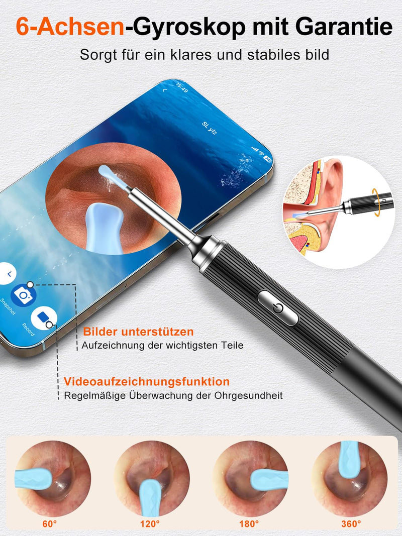 Earwax Remover, PARPAT Ear Cleaner Otoscope with 1080P HD Camera, IP67 Waterproof Ear Mirror 360° Wide Angle 6 LEDs Otoscope with Light, Earwax Removal Kit for iPhone, iPad, Android S16