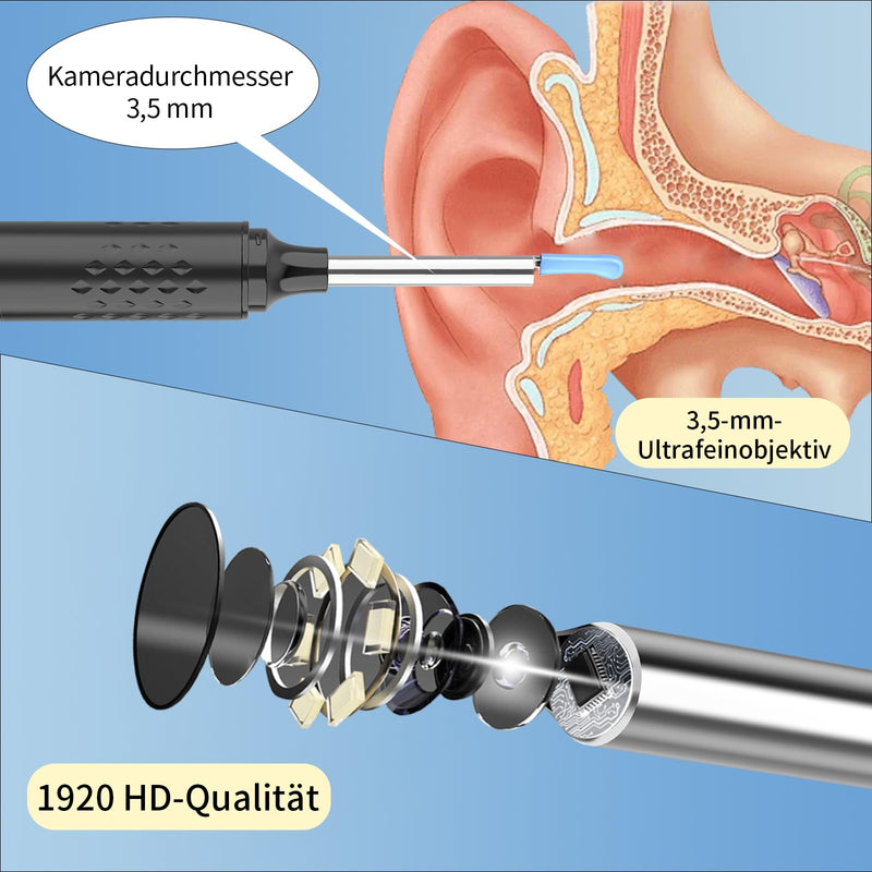 VITCOCO WI-FI 1080P Ear Wax Remover Otoscope, IP67 Waterproof Ear Cleaner for Adults, Ear Cleaning for iPhone, iPad and Android Smartphones