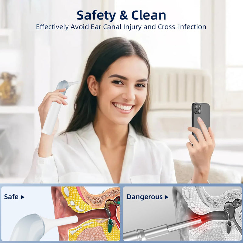 Qimic Wireless Otoscope Ear Camera - 1080P WiFi Otoscope with 6 LED Lights, Ear Scope Camera with 10 Colorful Accessories for Kids,Pets &Adults,Support Photo and Video, Compatible with Android Q09